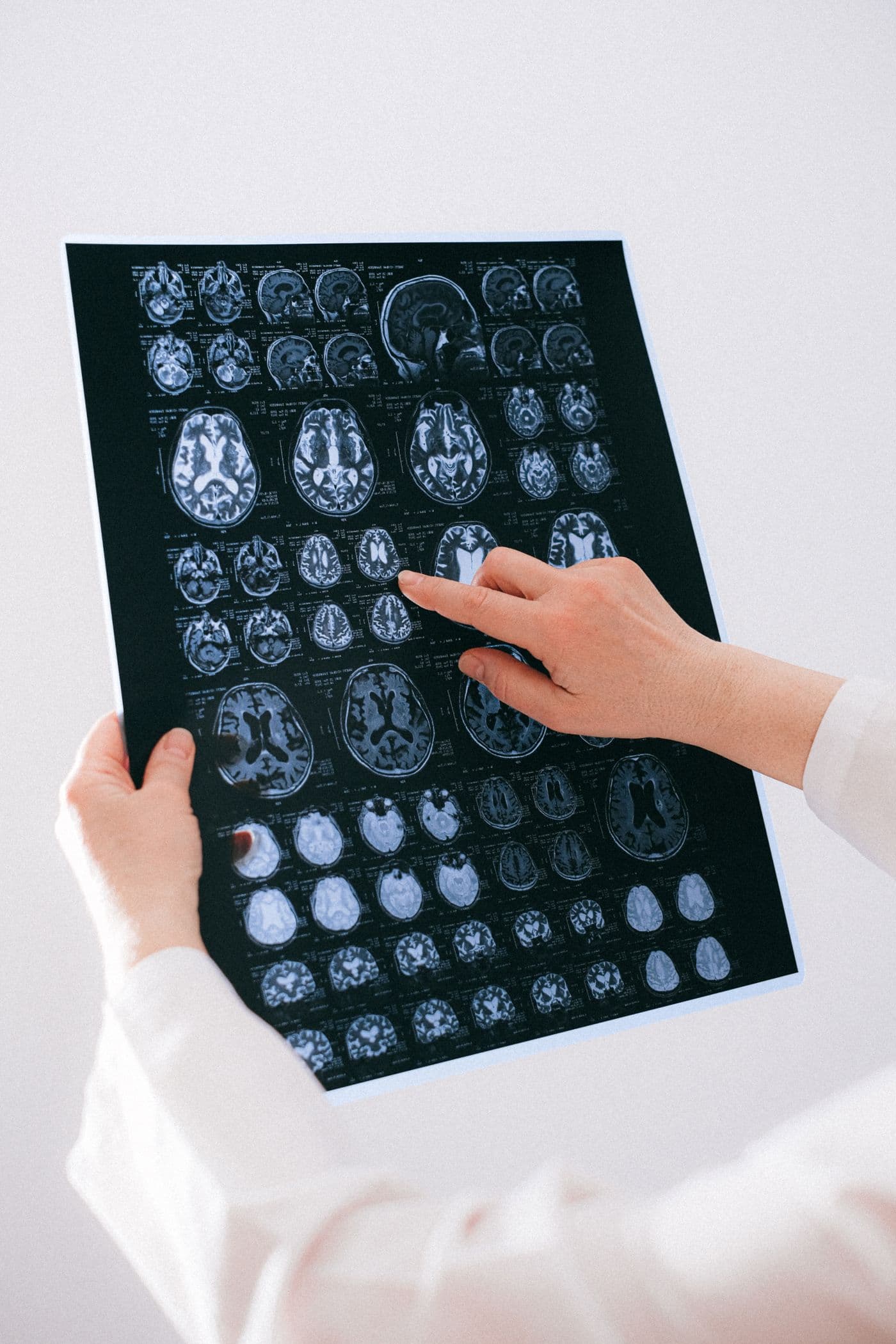 Imagini RMN ale creierului, examinate de un medic