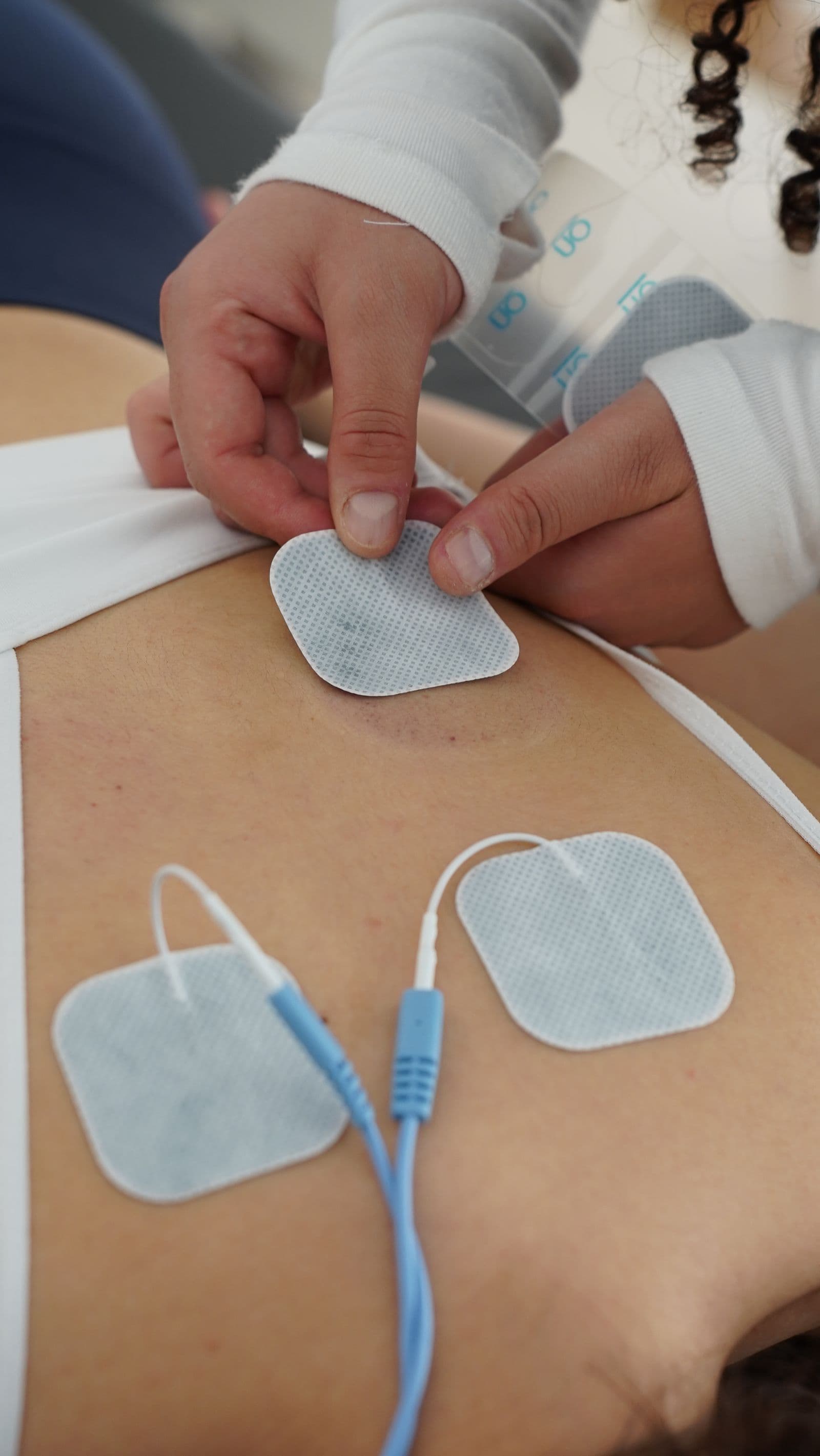 Electrozi de electrostimulare aplicați pe spatele unui pacient
